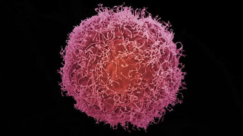 skincancercell.jpg
