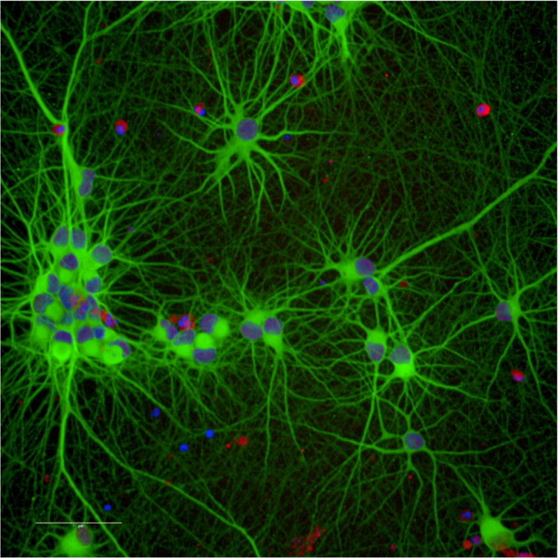tm_caspase3_ips-mn.png